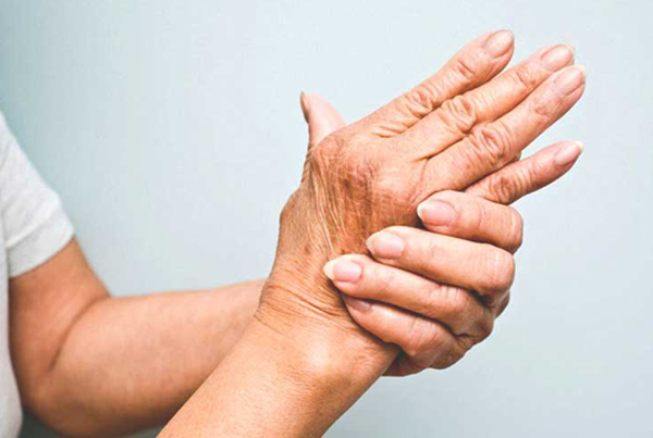 Psoriatic Arthritis